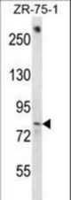 BACH1 Antibody western blot of ZR-75-1 cell line lysates (35 ug/lane). The BACH1 antibody detected the BACH1 protein (arrow).