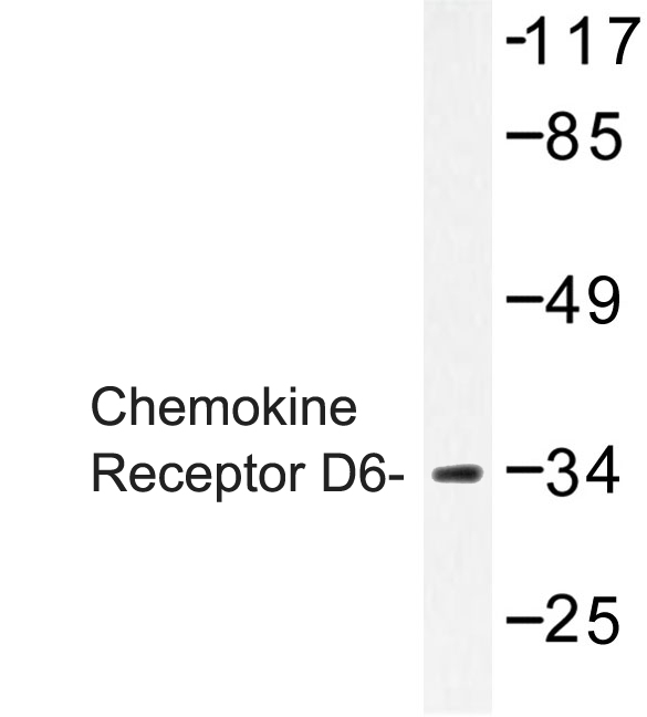 Western blot of Chemokine Receptor D6 (S383) pAb in extracts from HepG2.