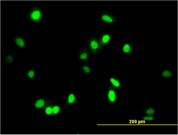 Immunofluorescence of monoclonal antibody to AATF on HeLa cell. [antibody concentration 10 ug/ml]