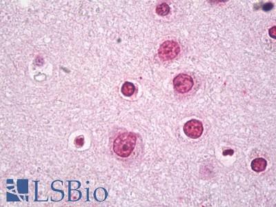 Anti-BACH2 antibody IHC of human brain, cortex neurons. Immunohistochemistry of formalin-fixed, paraffin-embedded tissue after heat-induced antigen retrieval. Antibody LS-B7533 concentration 10 ug/ml.