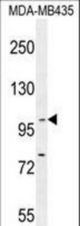 BACH2 Antibody western blot of MDA-MB435 cell line lysates (35 ug/lane). The BACH2 antibody detected the BACH2 protein (arrow).
