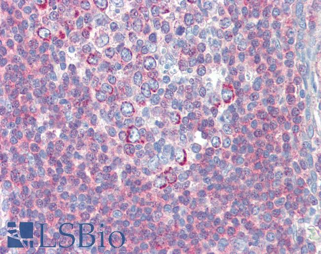 Anti-BACH2 antibody IHC of human tonsil. Immunohistochemistry of formalin-fixed, paraffin-embedded tissue after heat-induced antigen retrieval. Antibody LS-B3533 concentration 2.5 ug/ml.