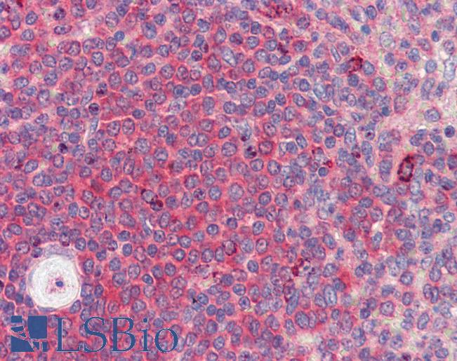 Anti-BACH2 antibody IHC of human spleen. Immunohistochemistry of formalin-fixed, paraffin-embedded tissue after heat-induced antigen retrieval. Antibody LS-B3533 concentration 2.5 ug/ml.