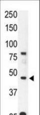 The anti-CCBP2 N-term antibody is used in Western blot to detect CCBP2 in mouse liver tissue lysate.