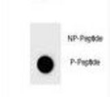 Dot blot of BAD Antibody (Phospho S124) Phospho-specific antibody on nitrocellulose membrane. 50ng of Phospho-peptide or Non Phospho-peptide per dot were adsorbed. Antibody working concentrations are 0.6ug per ml.