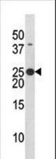 The anti-Phospho-Bad-S134 antibody is used in Western blot to detect Phospho-Bad-S134 in HL60 tissue lysate