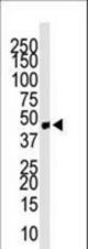 Western blot of anti-CCBP2 antibody in mouse small intestine tissue lysate. CCBP2 (Arrow) was detected using purified antibody. Secondary HRP-anti-rabbit was used for signal visualization with chemiluminescence.