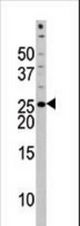The anti-Phospho-Bad-S118 antibody is used in Western blot to detect Phospho-Bad-S118 in HL60 tissue lysate