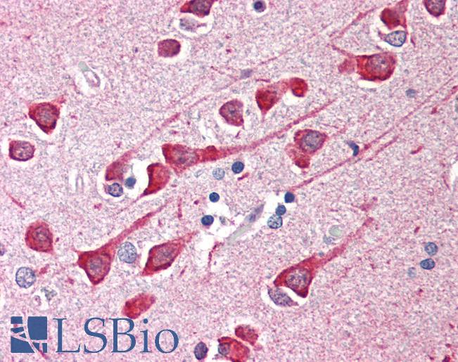 Anti-BAD antibody IHC of human brain, cortex. Immunohistochemistry of formalin-fixed, paraffin-embedded tissue after heat-induced antigen retrieval. Antibody LS-B461 concentration 5 ug/ml.