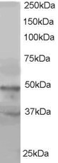 Antibody staining (1 ug/ml) of HeLa lysate (RIPA buffer, 35 ug total protein per lane). Primary incubated for 1 hour. Detected by Western blot of chemiluminescence.