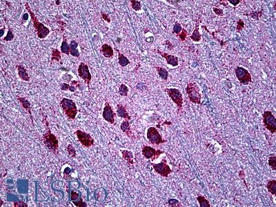 Anti-SMARCD2 antibody IHC of human brain, cortex. Immunohistochemistry of formalin-fixed, paraffin-embedded tissue after heat-induced antigen retrieval. Antibody LS-B5536 concentration 5 ug/ml.