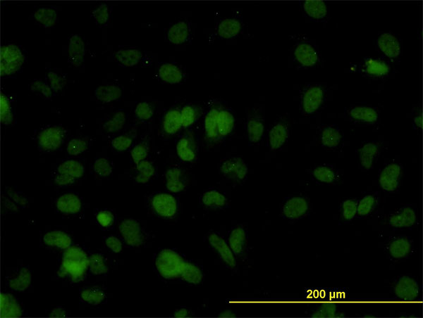 Immunofluorescence of monoclonal antibody to SMARCD2 on HeLa cell. [antibody concentration 10 ug/ml]