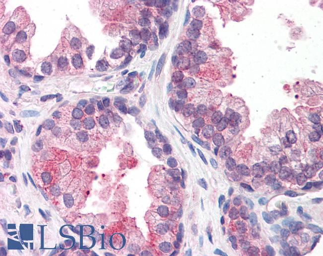 Anti-SMARCD2 antibody IHC of human prostate. Immunohistochemistry of formalin-fixed, paraffin-embedded tissue after heat-induced antigen retrieval. Antibody LS-B5599 concentration 5 ug/ml.