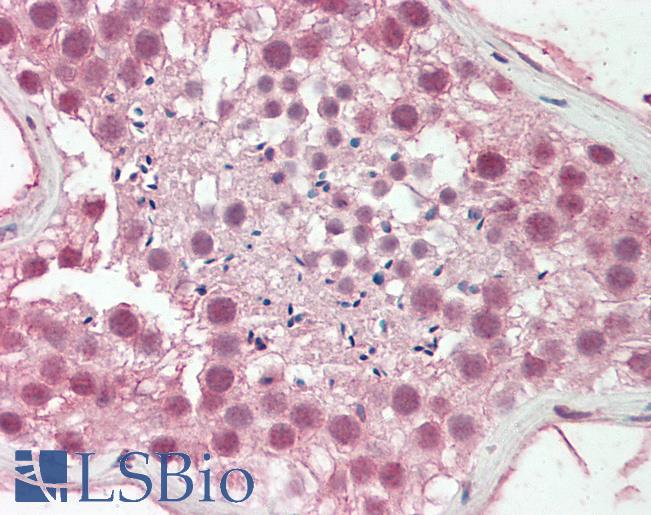 Human Testis: Formalin-Fixed, Paraffin-Embedded (FFPE)