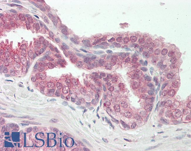 Human Prostate: Formalin-Fixed, Paraffin-Embedded (FFPE)