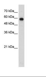 Jurkat Cell Lysate