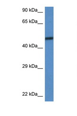 SMARCD3 antibody LS-C145286 Western blot of Mouse Brain lysate. Antibody concentration 1 ug/ml.