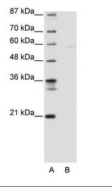 A: Marker, B: 293T Cell Lysate