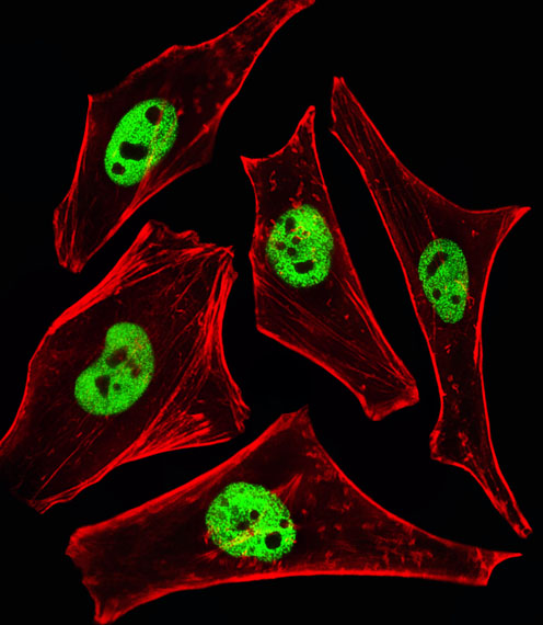 Fluorescent image of HeLa cells stained with SMARCD3 Antibody. Antibody was diluted at 1:25 dilution. An Alexa Fluor 488-conjugated goat anti-rabbit lgG at 1:400 dilution was used as the secondary antibody (green). Cytoplasmic actin was counterstained with Alexa Fluor 555 conjugated with Phalloidin (red).
