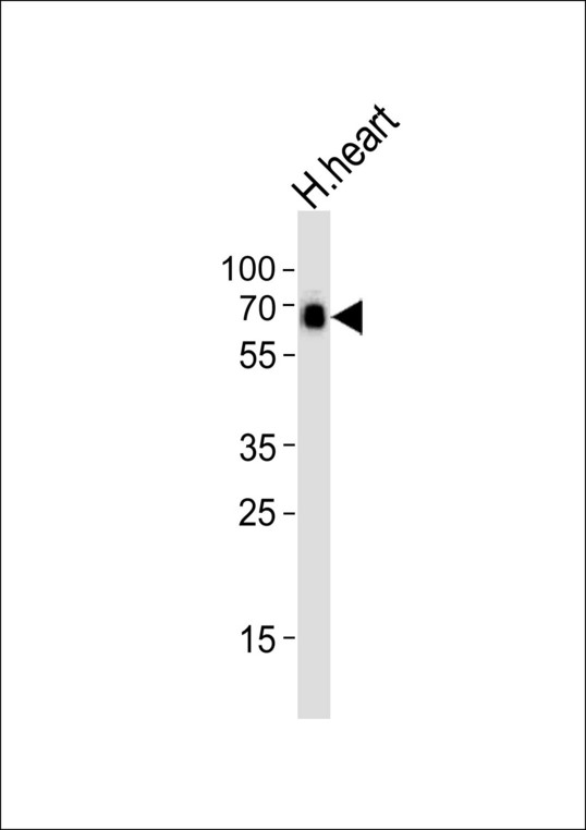 Western blot of lysate from human heart tissue lysate with SMARCD3 Antibody. Antibody was diluted at 1:1000. A goat anti-rabbit IgG H&L (HRP) at 1:5000 dilution was used as the secondary antibody. Lysate at 35 ug.