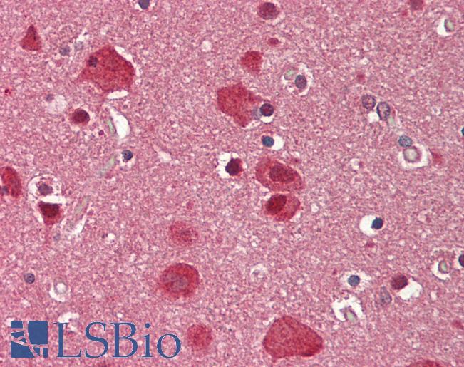 Human Brain, Cortex: Formalin-Fixed, Paraffin-Embedded (FFPE)