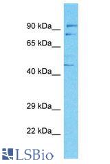 BAF60C / SMARCD3 antibody Western Blot of Jurkat whole cell lysate. Antibody dilution: 1 ug/ml.