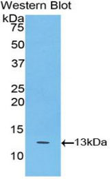 Western blot of recombinant BAFF Receptor / BAFF-R.