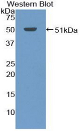 Western blot of recombinant BAFF Receptor / BAFF-R.
