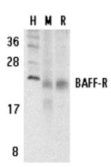 Western blot of BAFF-R in human (H), mouse (M), and rat (R) spleen tissue lysates with BAFF-R antibody at 5 ug/ml.