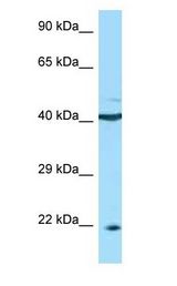 BAFF Receptor / BAFF-R antibody Western Blot of 721_B.