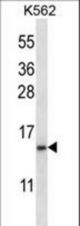 TNFRSF13C Antibody western blot of K562 cell line lysates (35 ug/lane). The TNFRSF13C antibody detected the TNFRSF13C protein (arrow).