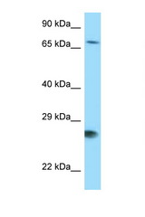 BAG1 antibody LS-C146176 Western blot of 721_B Cell lysate. Antibody concentration 1 ug/ml.