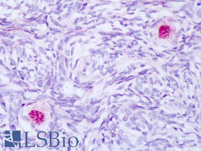 Anti-BAG-1 antibody IHC of human ovary. Immunohistochemistry of formalin-fixed, paraffin-embedded tissue after heat-induced antigen retrieval. Antibody LS-B8264 dilution 5-10 ug/ml.