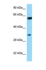 BAG1 antibody LS-B8264 Western blot of HeLa Cell lysate. Antibody concentration 1 ug/ml.