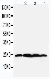 WB of BAG2 antibody. Lane 1: Rat Testis Tissue Lysate. Lane 2: HELA Cell Lysate. Lane 3: A549 Cell Lysate. Lane 4: A431 Cell Lysate.
