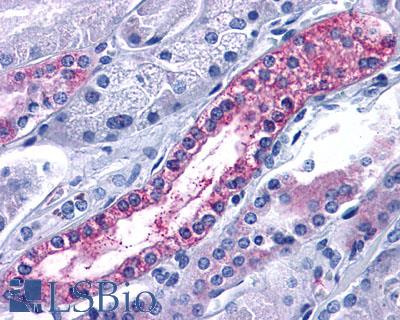 Anti-CXCR7 antibody LS-A1893 IHC of human kidney, renal tubule. Immunohistochemistry of formalin-fixed, paraffin-embedded tissue after heat-induced antigen retrieval.