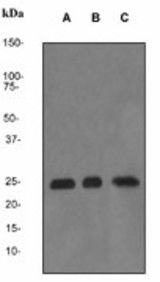 Western blot analysis on (A) Jurkat (B) HeLa and (C) HepG2 cell lysate using anti-Bag2 antibody (LS-C105560), dilution 1:5000.