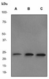 Western blot analysis on (A) Jurkat (B) HeLa and (C) A549 cell lysate using anti-Bag2 antibody (LS-C105572), dilution 1:2000.