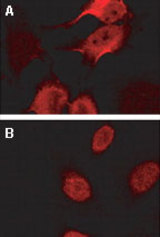 Immunofluorescence confocal microscopy of BAG-2 using LS-C148216 at 1:2000. HeLa cells stably transfected with Myc-CHIP (