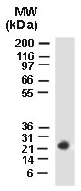Western blot of BAG-2 using LS-C148216 at 1:2000. HeLa stably transfected Myc-tagged CHIP (
