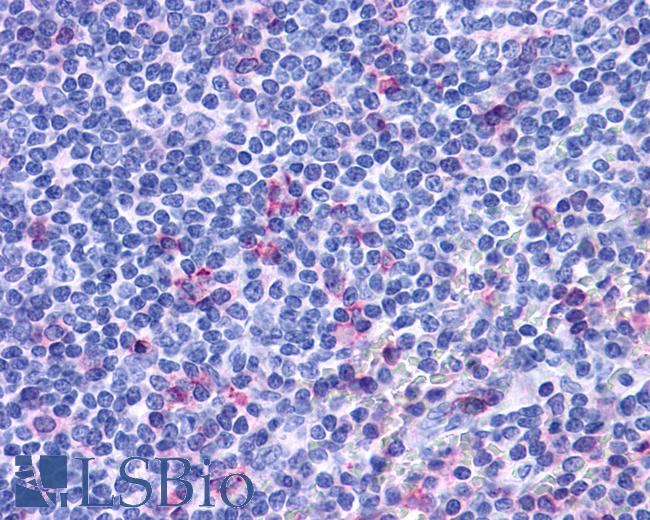 Anti-ACKR3 / CXCR7 / RDC1 antibody IHC of human tonsil. Immunohistochemistry of formalin-fixed, paraffin-embedded tissue after heat-induced antigen retrieval.