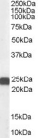 Antibody (0.3 ug/ml) staining of Hela lysate (35 ug protein in RIPA buffer). Primary incubation was 1 hour. Detected by chemiluminescence.