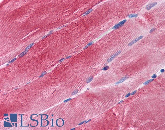 Anti-BAG3 antibody IHC of human skeletal muscle. Immunohistochemistry of formalin-fixed, paraffin-embedded tissue after heat-induced antigen retrieval. Antibody LS-B3925 concentration 3.75 ug/ml.