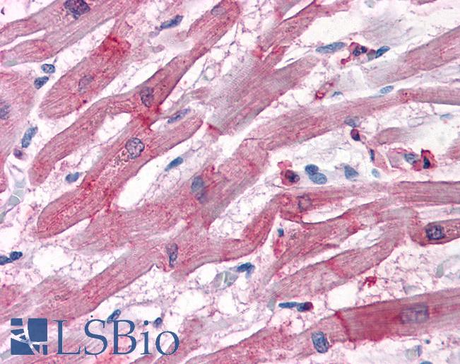 Anti-BAG3 antibody IHC of human heart. Immunohistochemistry of formalin-fixed, paraffin-embedded tissue after heat-induced antigen retrieval. Antibody LS-B3925 concentration 3.75 ug/ml.
