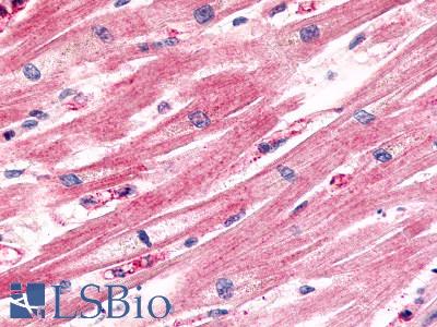 Anti-CCRL1 antibody LS-A1441 IHC of human heart, cardiac myocytes. Immunohistochemistry of formalin-fixed, paraffin-embedded tissue after heat-induced antigen retrieval.