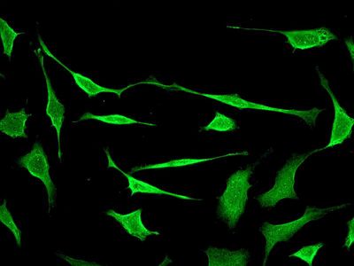 Immunofluorescent staining of HeLa cells using anti-SODD antibody.