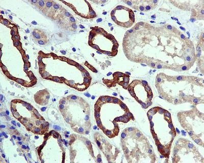 IHC of paraffin-embedded human kidney tissue using anti-SODD antibody.