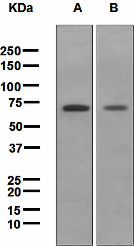 Western blot analysis on (A) HeLa and (B) Molt-4 cell lysates using anti-SODD antibody.