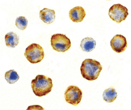 Immunocytochemistry of SODD in HeLa cells with SODD antibody at 5 ug/ml.