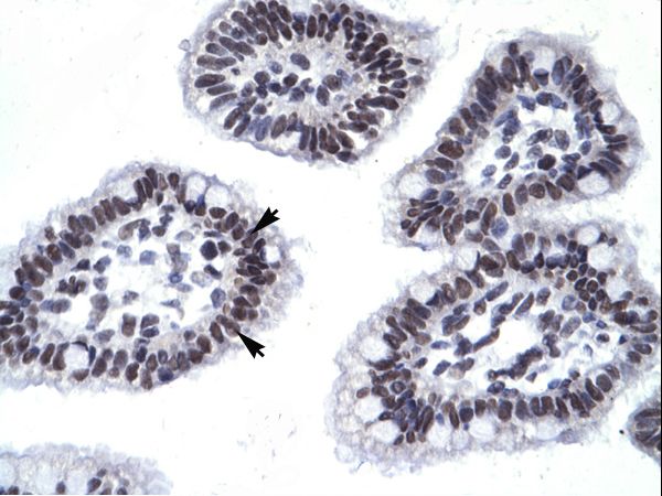 AATF antibody LS-C29956 was used in IHC to stain formalin-fixed, paraffin-embedded human intestine.